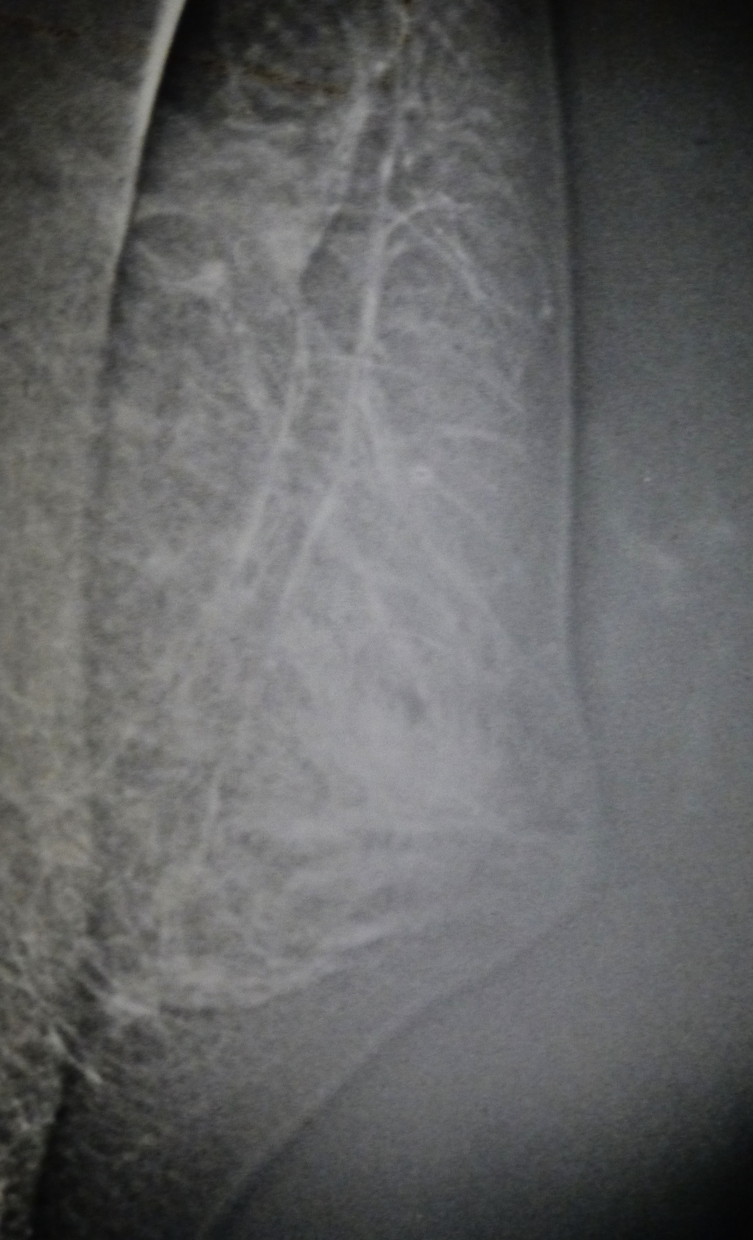 radiographie montrant les deux épaisseurs de glande mammaire à droite